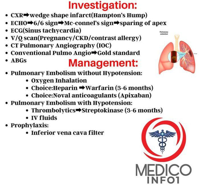 Pulmonary embolism-investigation and Management