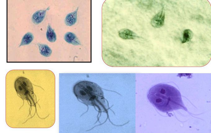 Guess 👆 What is the name of this parasite !?🌠