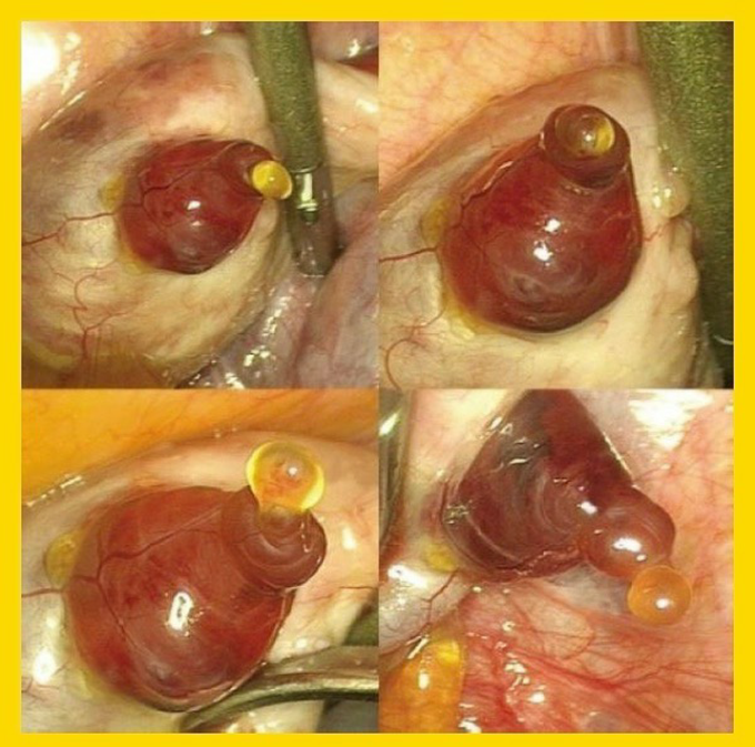 OVULATION