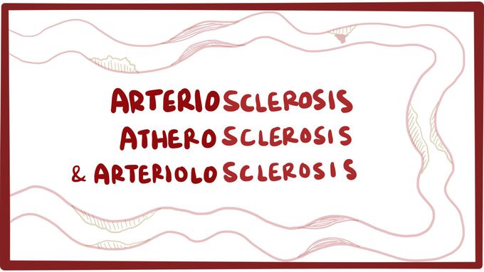 Arteriosclerosis, atherosclerosis, and arteriolosclerosis - causes, symptoms & pathology