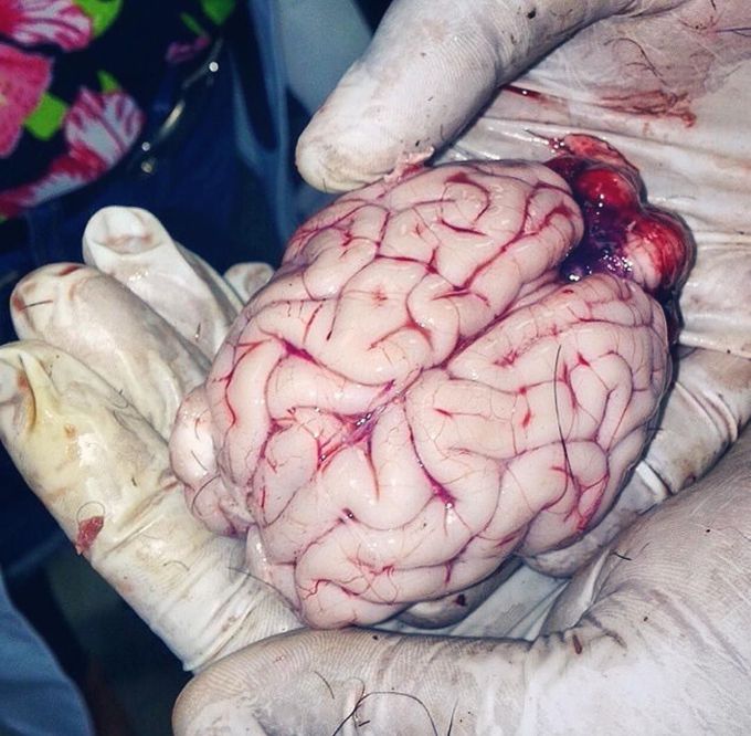 A brain of an infant