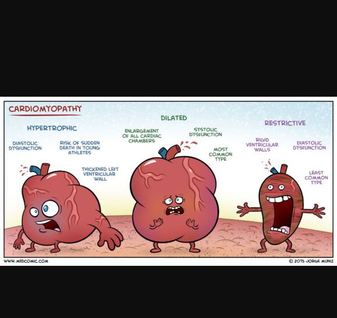 Diff types of cardiomyopathy ?!?