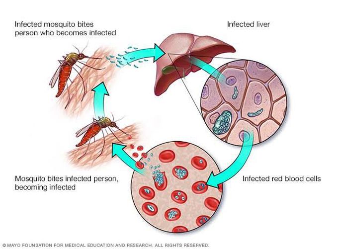 Malaria symptoms