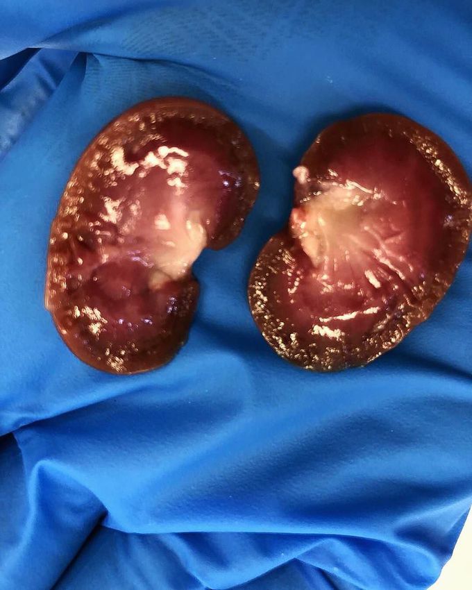 Smallest kidneys cross section!