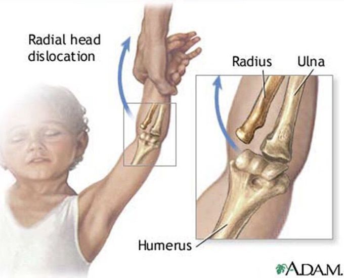 🔸 Guess the diagnosis !!