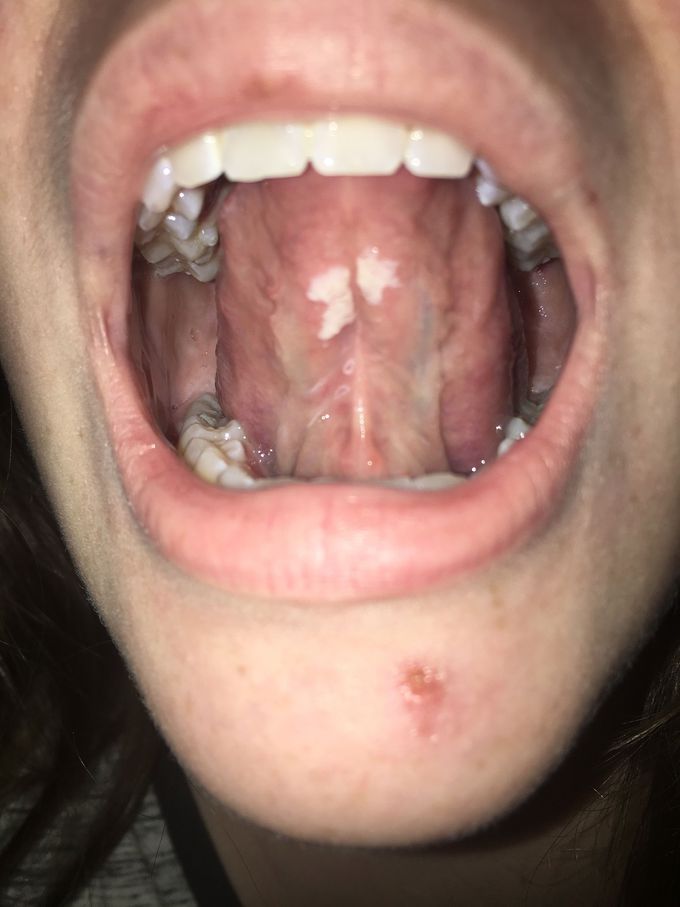 Mystery Sickness? What's your diagnoses?