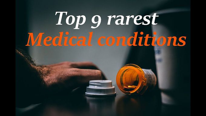 Top 9 rarest medical conditions you won't believe they exist