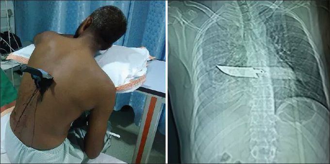 How surgeon managed this case?