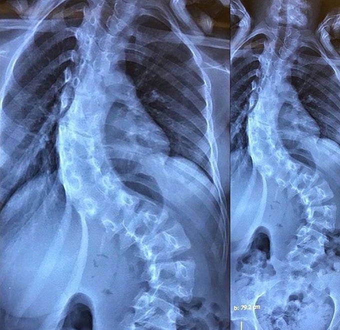 What's your diagnosis?