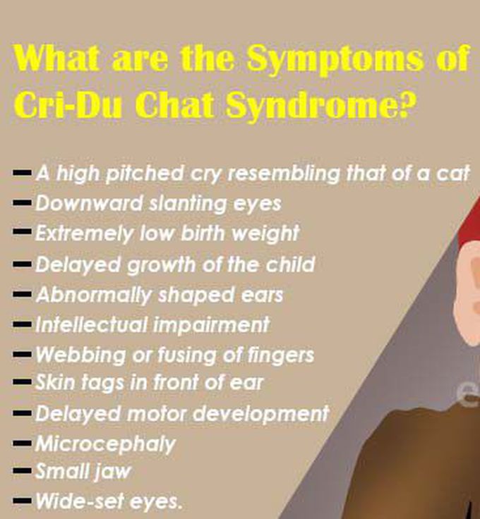 Symptoms Of Cri du chat Syndrome MEDizzy
