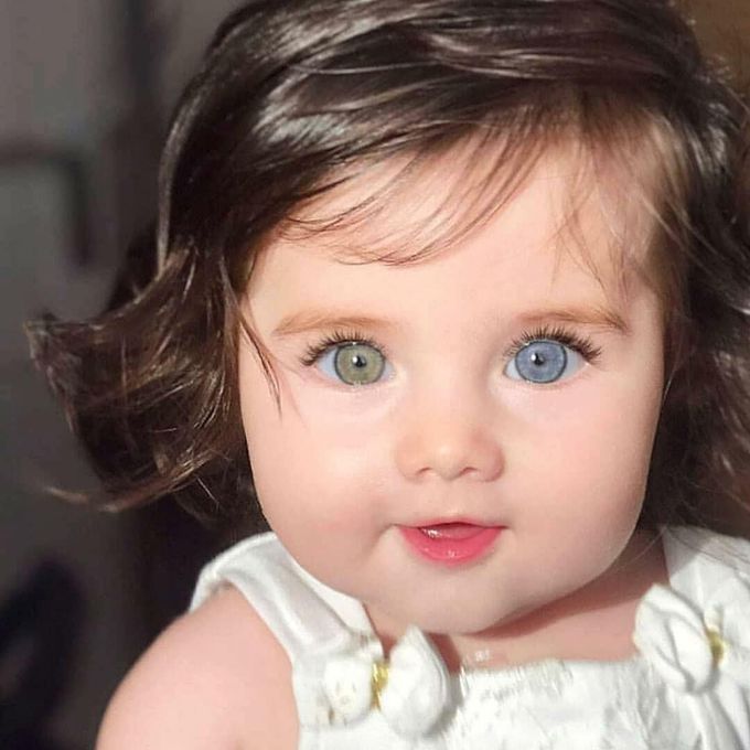 Cutest mutation ever 😍 Hetrochromia