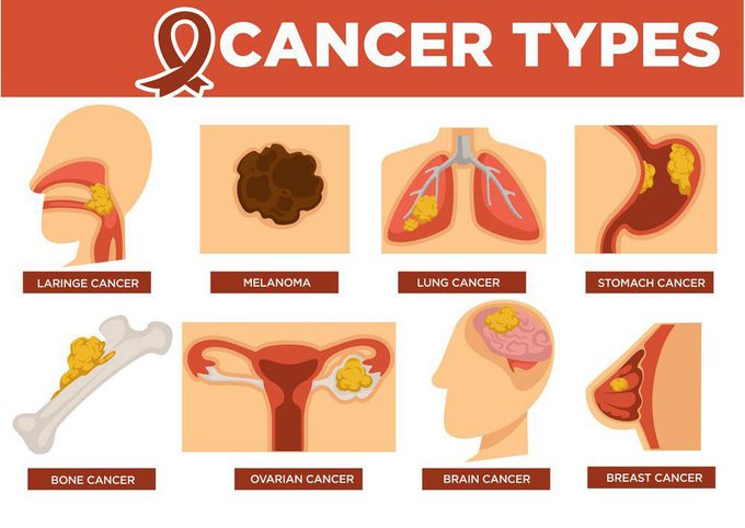 Types of Cancer