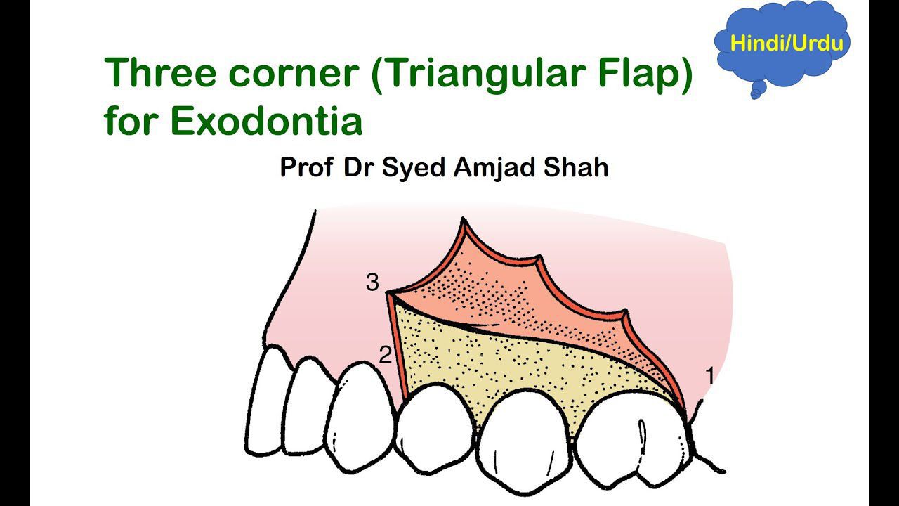 Three cornered flap - MEDizzy