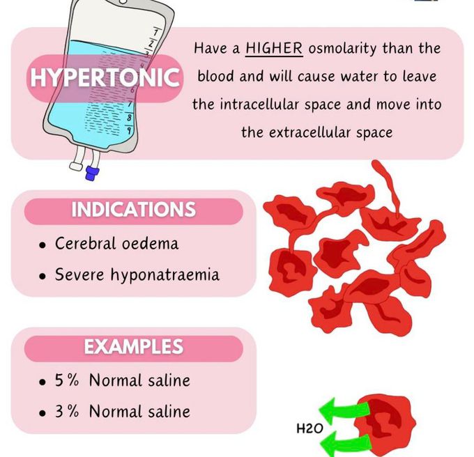 Hypertonic Fluid