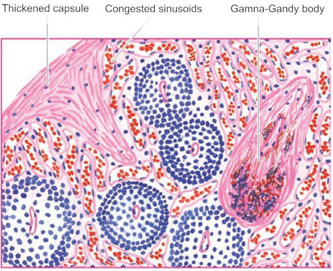 CVC spleen