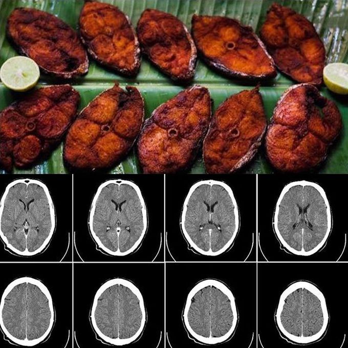 Easiest way to explain how CT machine works to patients in rural...lol