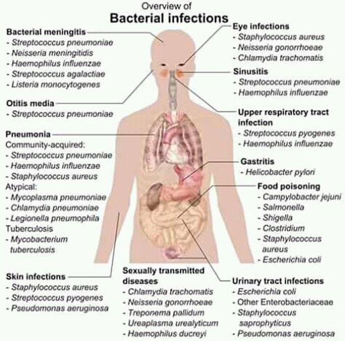 Infectiuos
