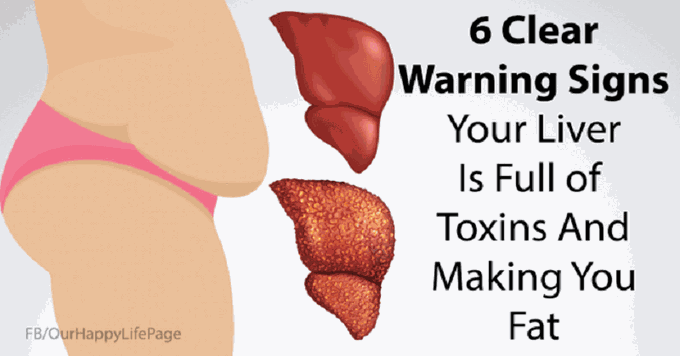 6 Signs That Your Liver Is Full Of Toxins And Making You Fat (And How To Stop It)