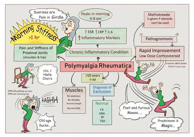 Polymyalgia Rheumatica