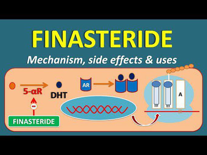 Benign Prostatic Hyperplasia -Finasteride