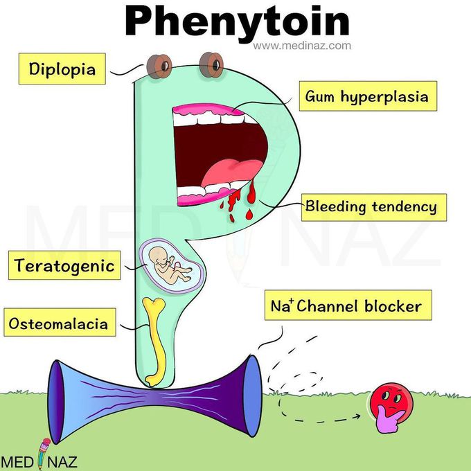 Phenytoin- side effects