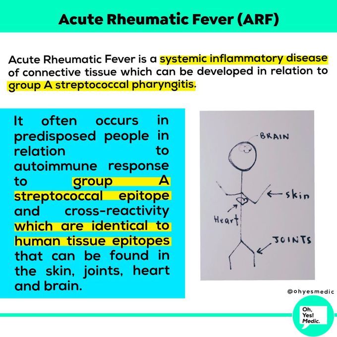 Acute Rheumatic Fever