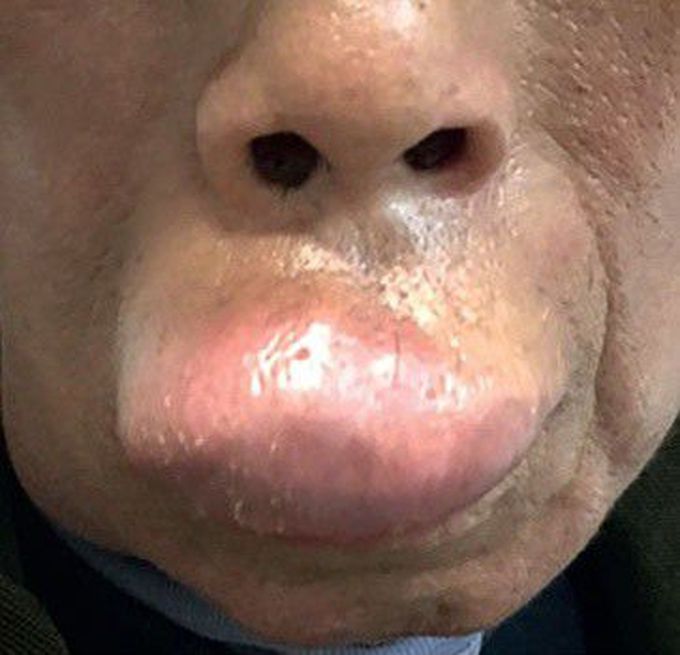 What is the probable diagnosis...