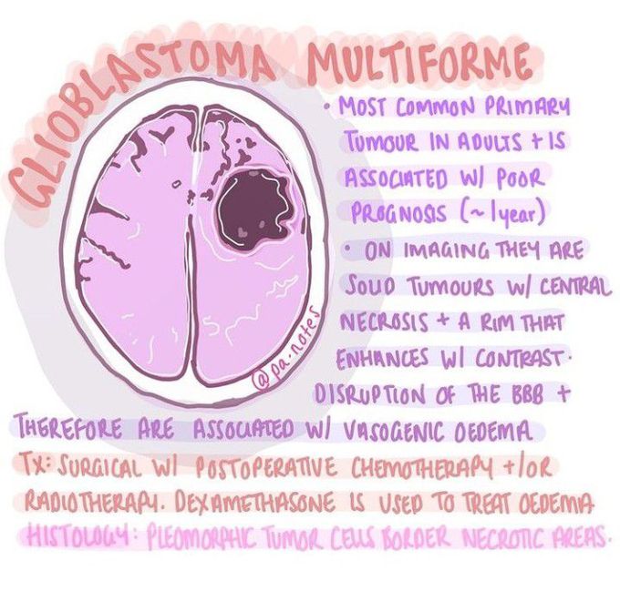 Glioblastoma multiforme