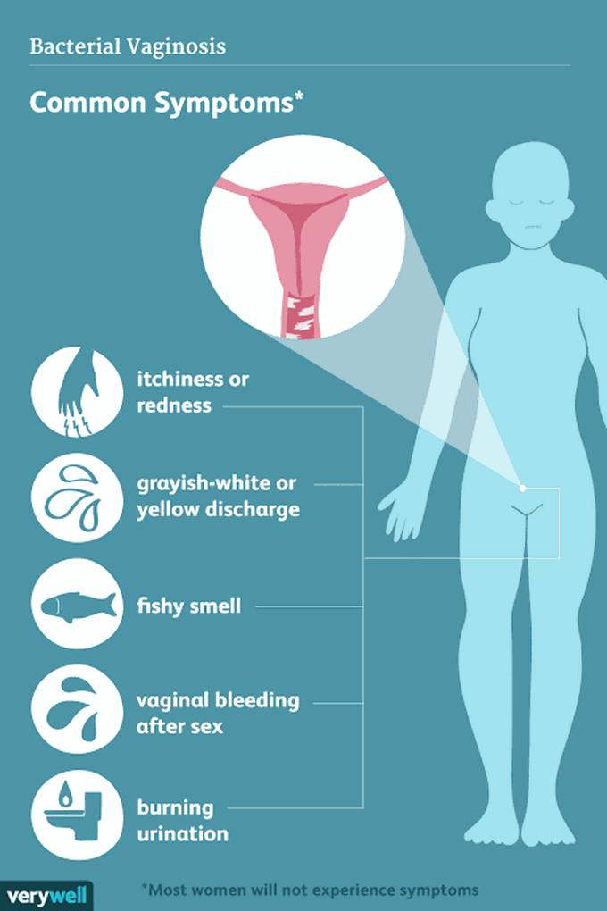 Symptoms of bacterial vaginosis