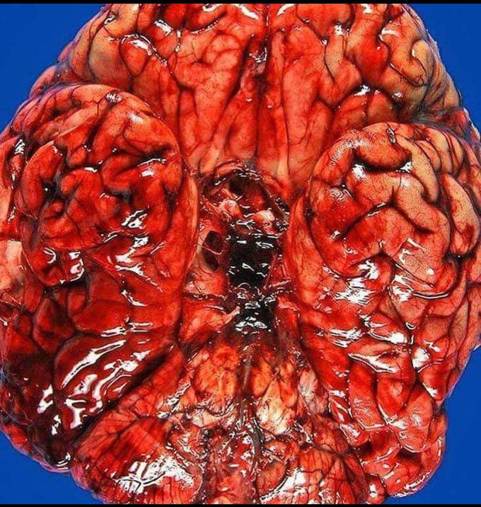 What is your diagnosis ??