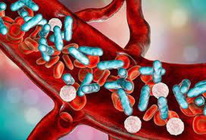 Causes of septicemia