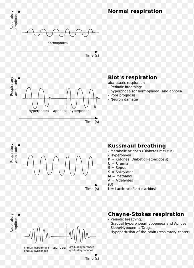 Breathing pattern abnormalities - MEDizzy
