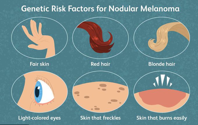 Cause of Melanoma