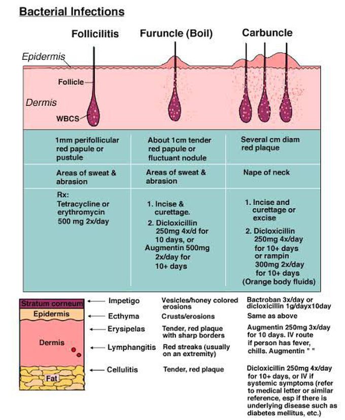 Bacterial infection of hair follicles