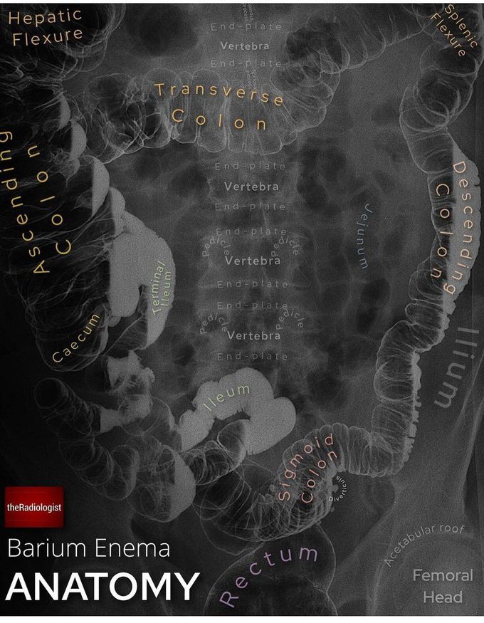 Barium Enema Anatomy