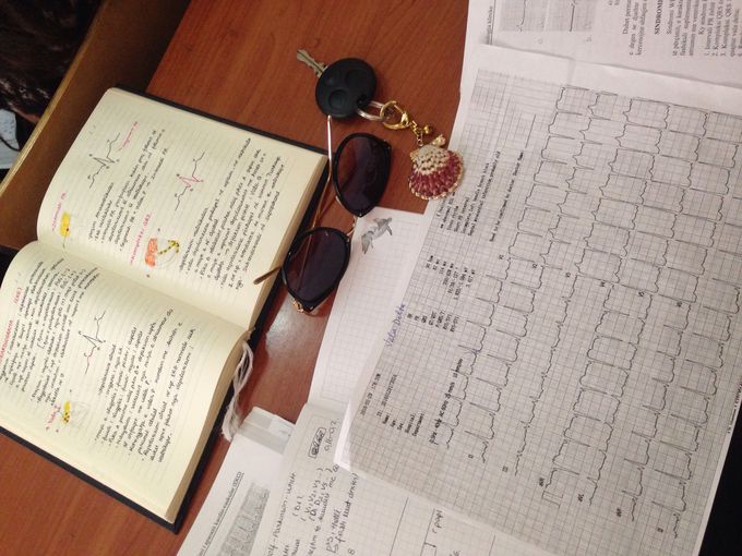 ECG-Electrocardiography