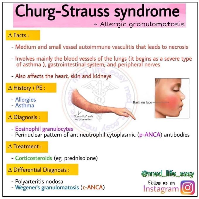 Churg-strauss syndrome