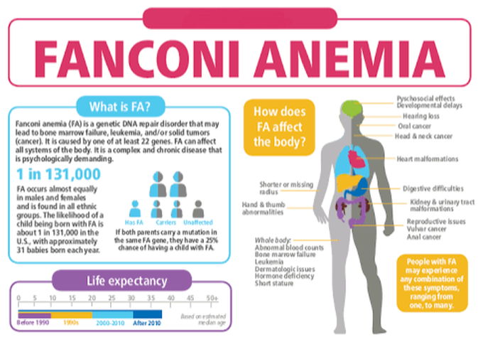 Fanconi Anemia