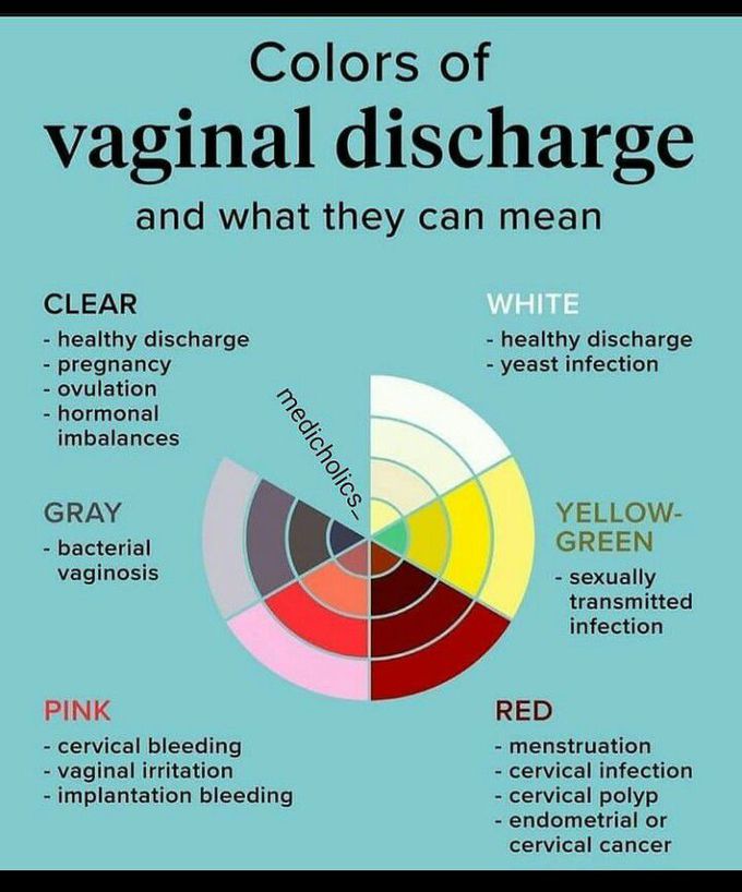 Vaginal Discharge Medizzy 3932