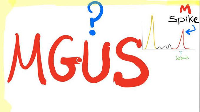 Monoclonal gammopathy of uncertain significance - MEDizzy