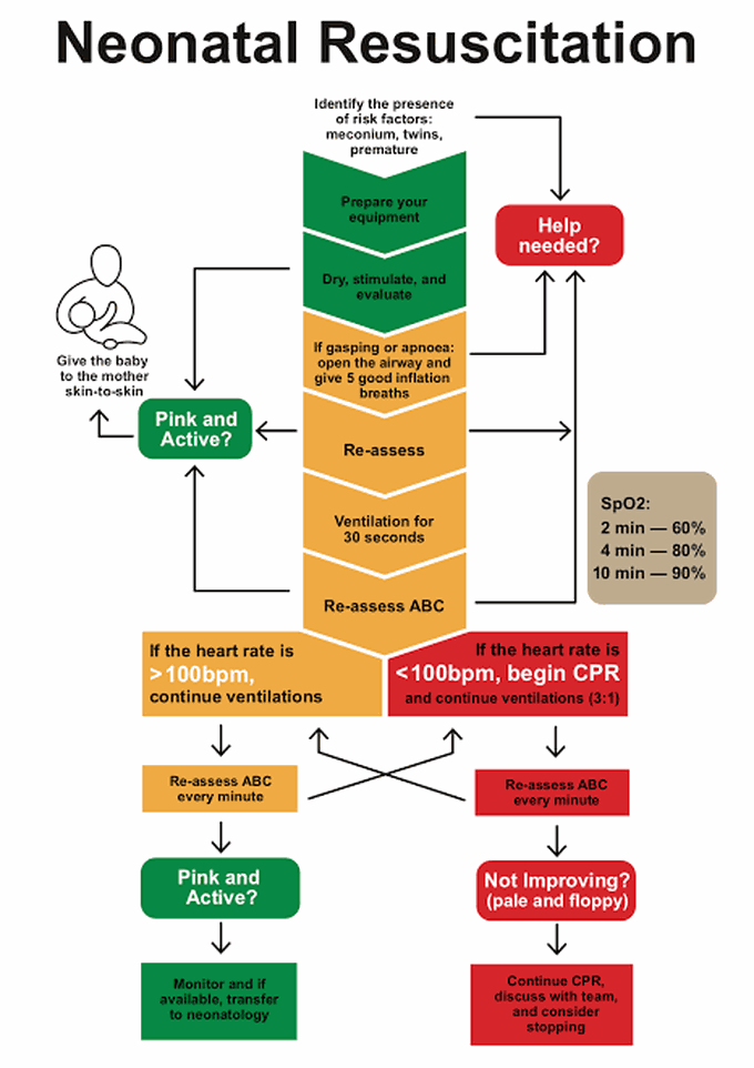 Steps of neonatal resuscitation MEDizzy