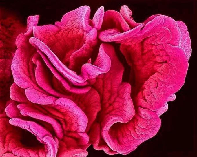 Fimbriae of a Fallopian tube - MEDizzy