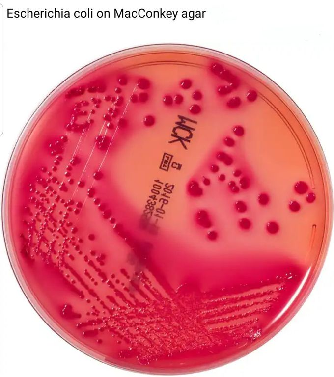 Escherichia coli