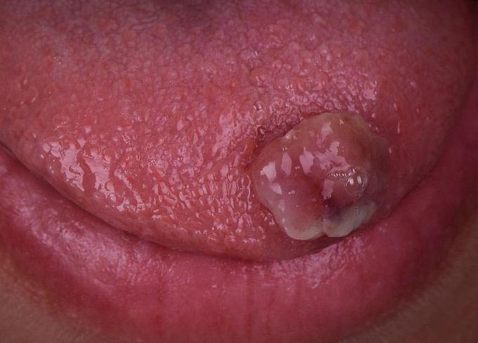 Diagnose it