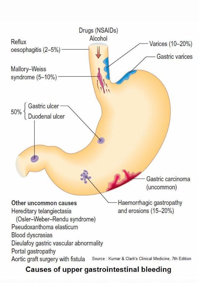 Referred stomach pain when the human drink alcoholic pills ,drinks or take drugs , u as a doctor/future doctor do you drink alcoholic drinks (cuz you now how much it’s dangerous for your body) ??