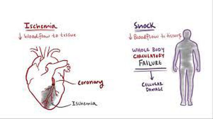 Treatment for obstructive shock