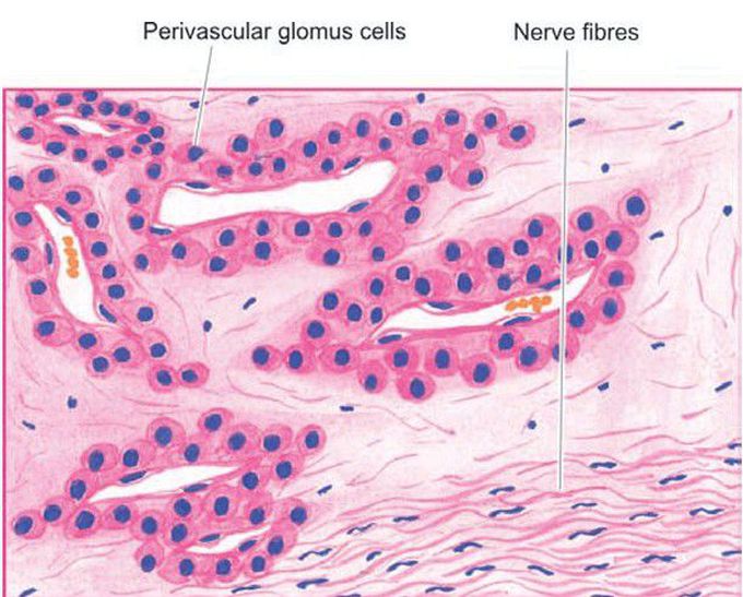 Glomus tumour