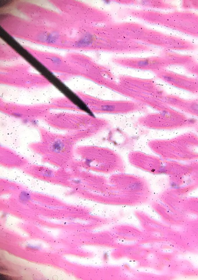 Cardiac muscle under microscope