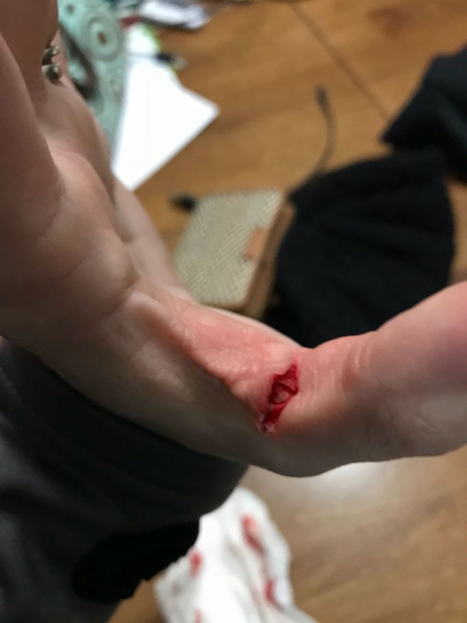 Don’t play with knifes