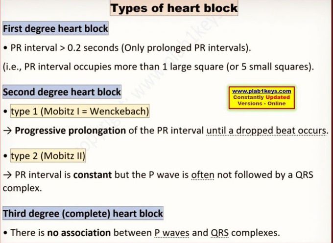 Types of Heart Block